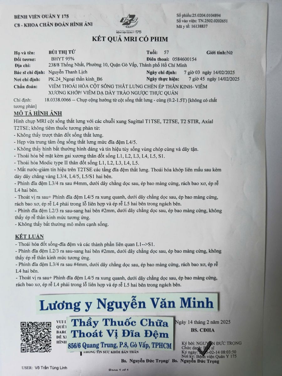 Thuốc chữa thoát vị đĩa đệm tốt